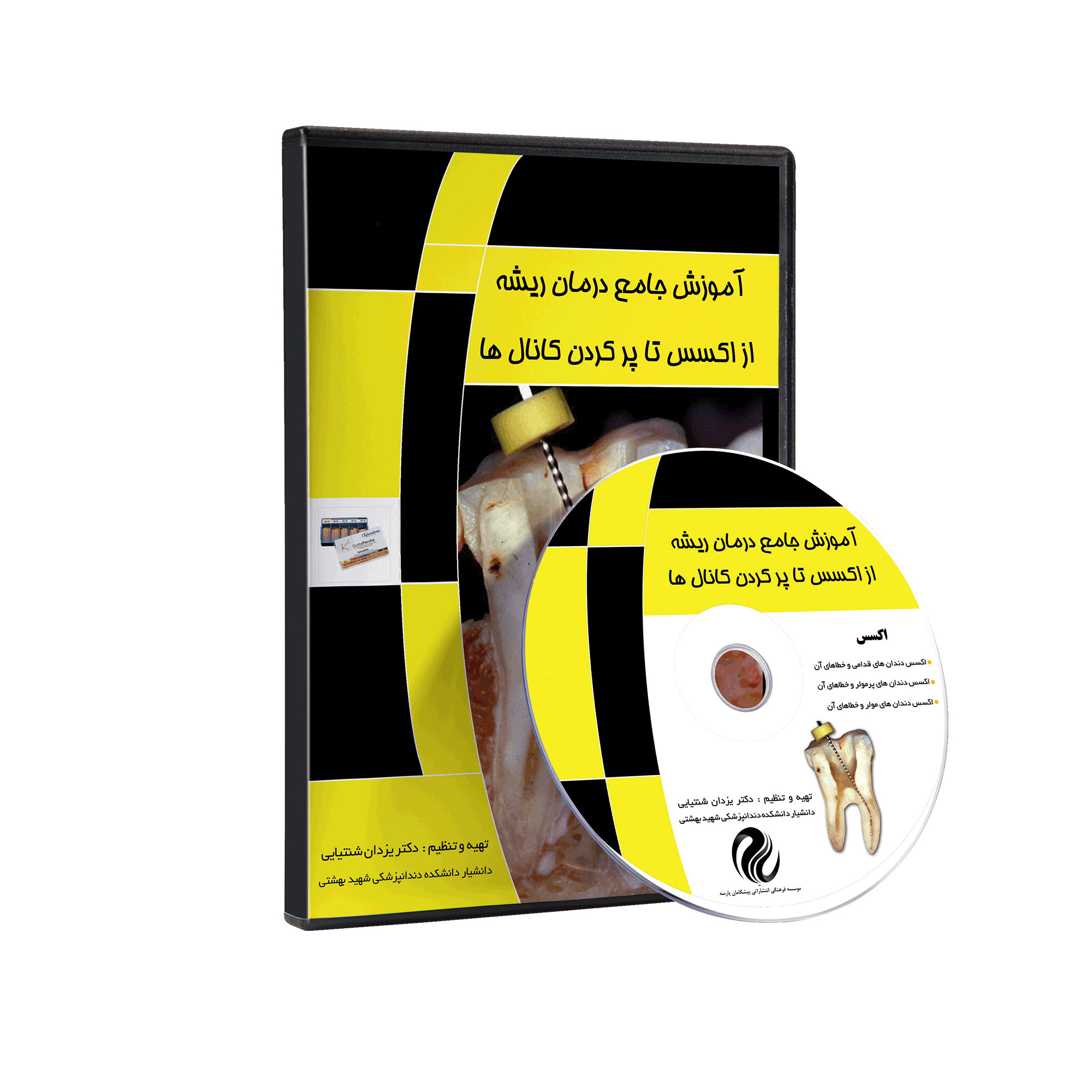 آموزش جامع درمان ریشه از اکسس تا پرکردن کانال ها